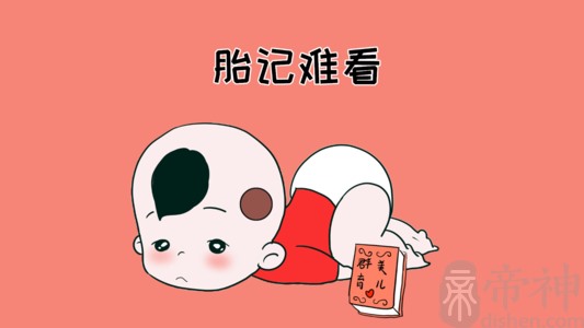 右大腿外侧有胎记命运 有胎记的孩子是什么转世