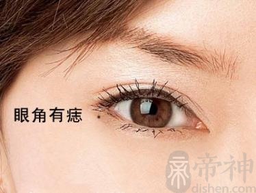 女性右眼上的痣有什么寓意 眼睛痣相解析
