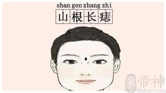 女人鼻子山根上长瘊子好不好 有什么含义