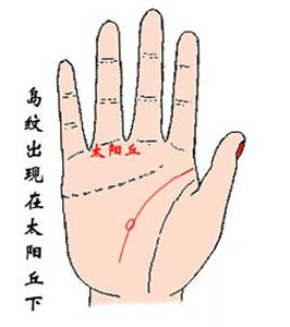 3,岛型纹出现在太阳丘下