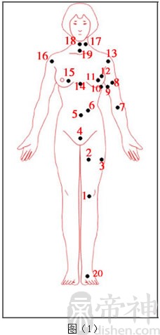 左胸下痣的位置示意图图片